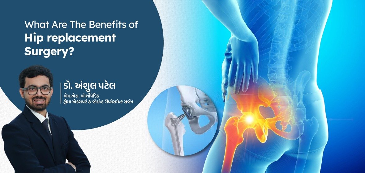 Benefits of Hip Replacement Surgery