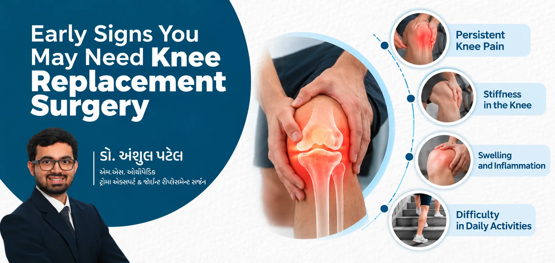 Early Signs You May Need Knee Replacement Surgery