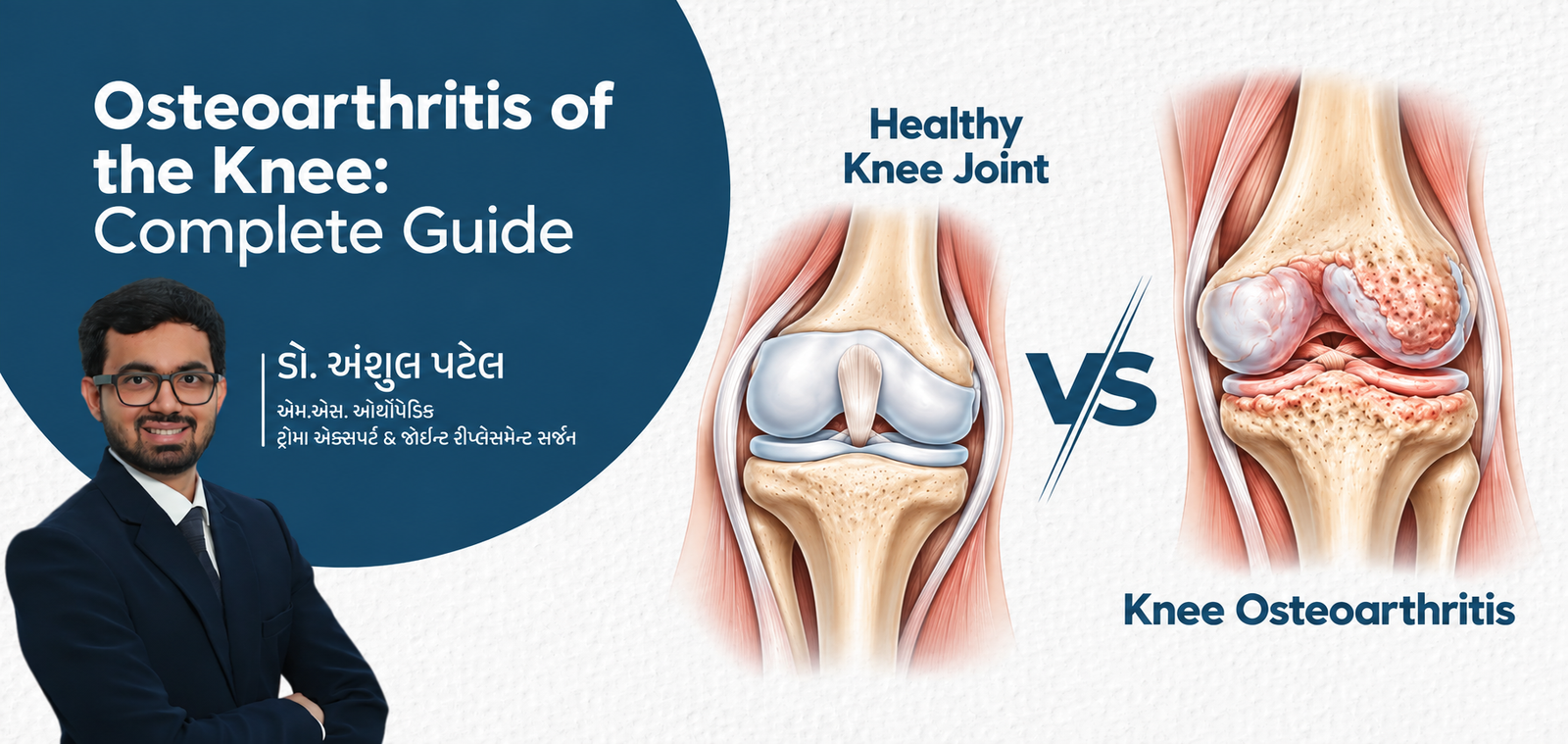 Benefits of Shoulder Replacement Surgery