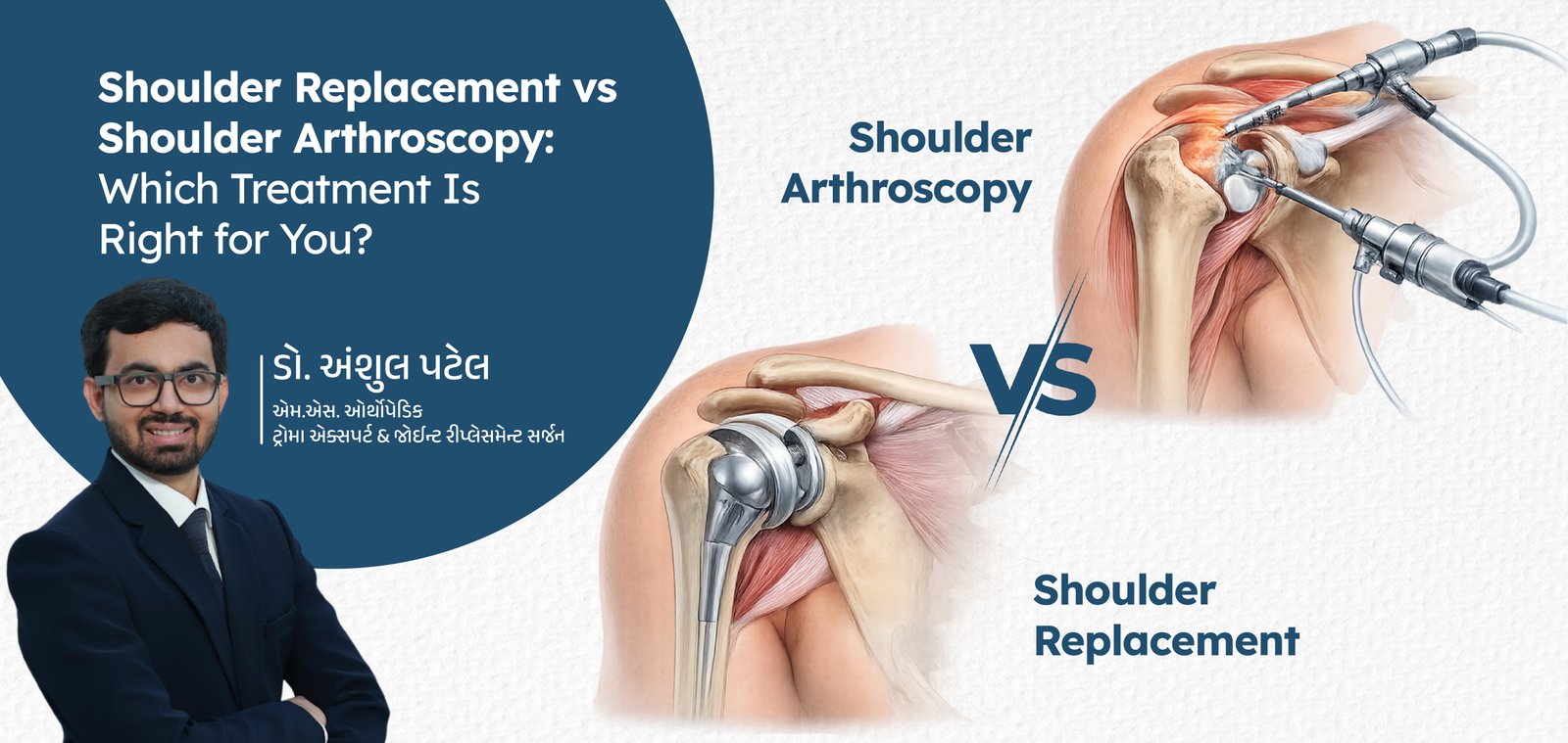 Total Knee Replacement: Procedure, Recovery, and What to Expect