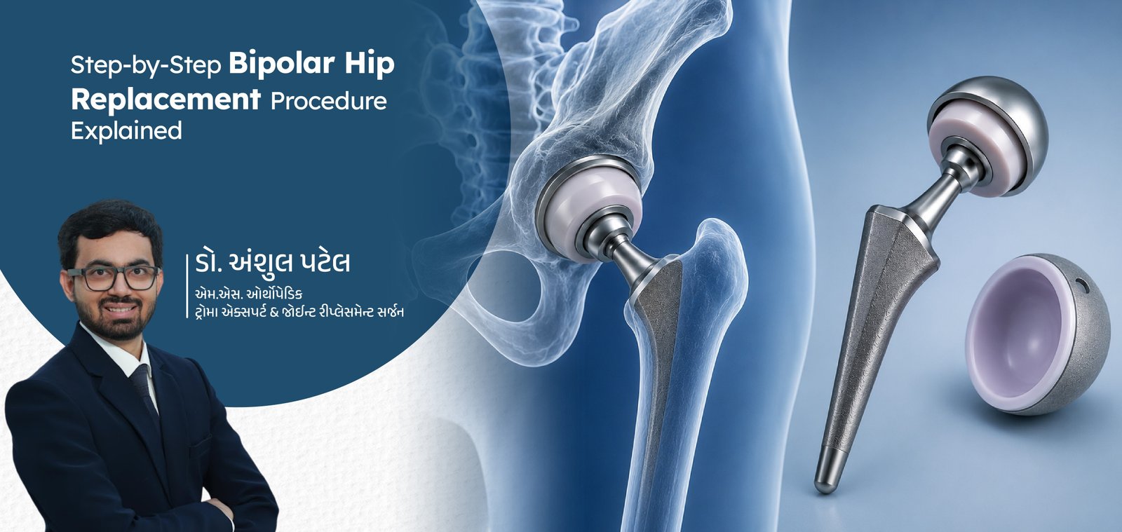 Knee Replacement Recovery Time: A Patient’s Guide