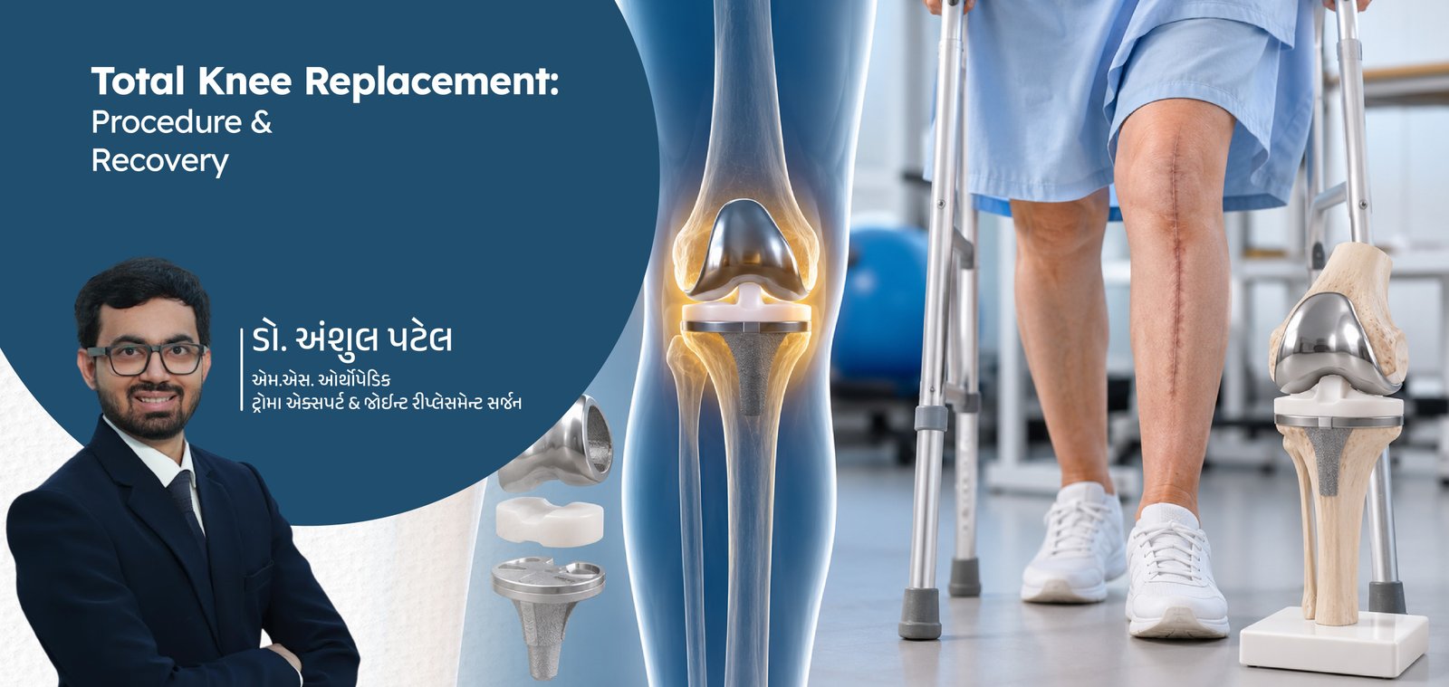Total Knee Replacement: Procedure, Recovery, and What to Expect