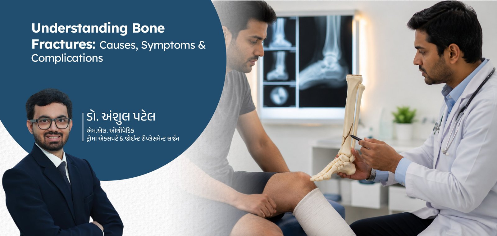 Understanding Bone Fractures: Causes, Symptoms & Complications